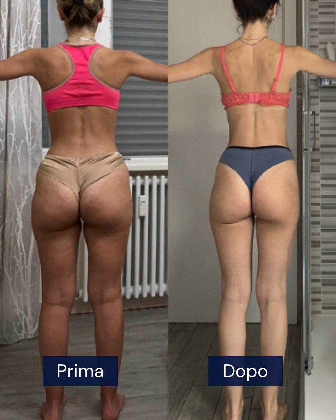 Risultato corpo ginoide CFP