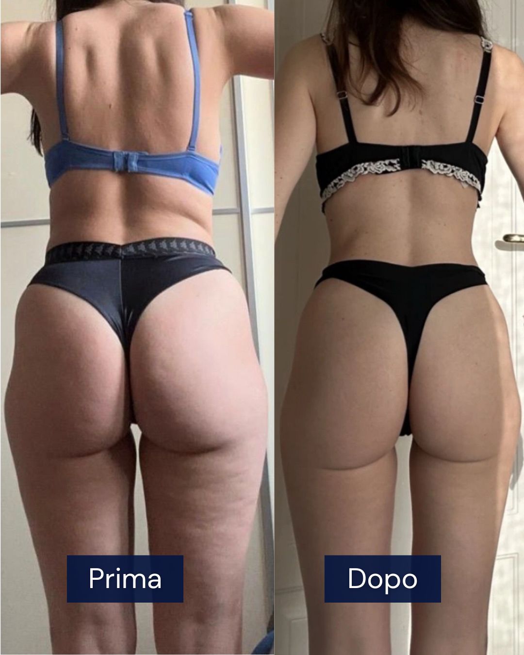 Risultato corpo ginoide CFP